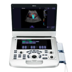 Ecógrafo Portátil EDAN Acclarix AX3