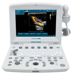 Ecógrafo Portátil EDAN U50
